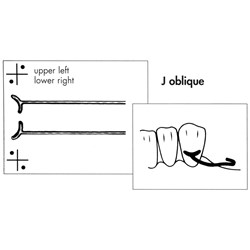 Scheu J Oblique Clasp - 0.9mm, 100-Pack