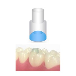 NAOL Mini-Mold Post Molar Pads-10