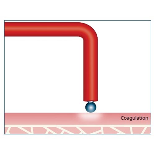 Coagulation