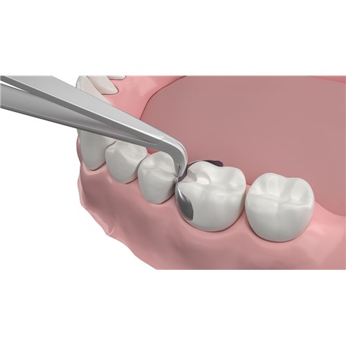 large-Band-ToolOnTeeth
