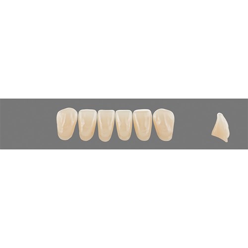 5M2 Lower L10 Anterior L3 - L15