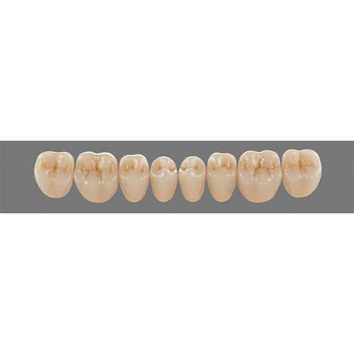 Vita MFT Lower, Posterior, Shade 4L15 C3, Mould PL33