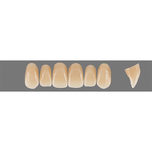 C2 Upper X2L Anterior