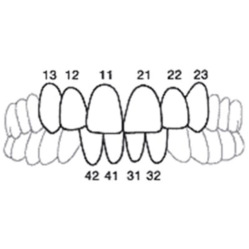 Directa CoForm - Pre-Formed Transparent Celluloid Matrices - 11D , 8-Pack