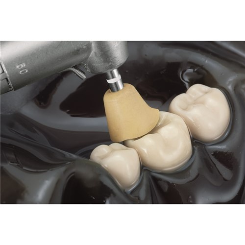 Komet Composite Polisher - 9525UF-085 - Ultra Fine - Diamond Grit - Slow Speed, Right Angle (RA), 1-Pack