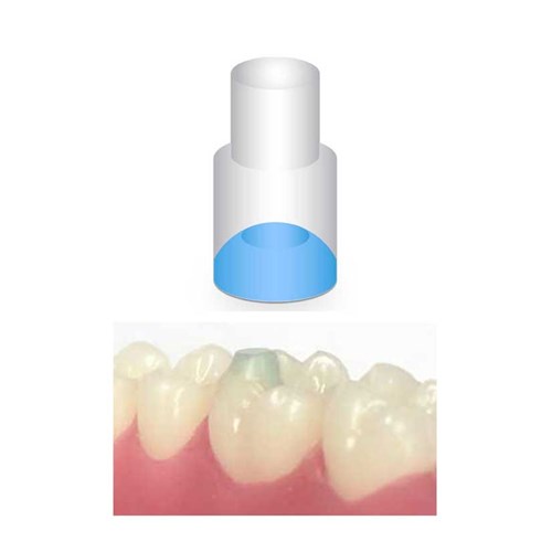 NAOL Mini-Mold Post Molar Pads-10
