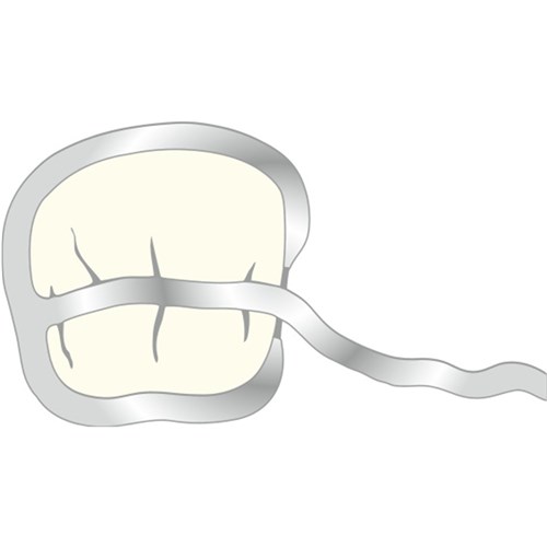 T Clasp 1.0mm Pack of 10