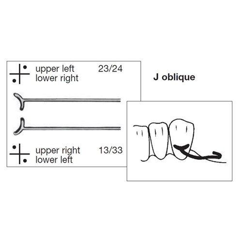 Scheu J Oblique Clasp - 1.1mm, 10-Pack