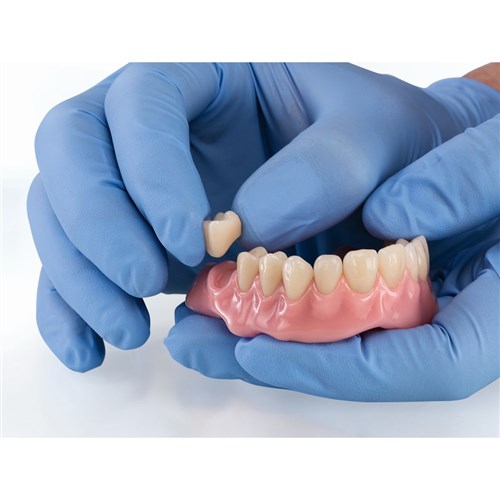 Vita VIONIC VIGO - Posterior - Shade B3, Mould 23L - OK Upper