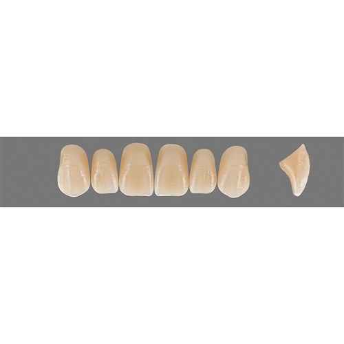B2 Upper T47 Anterior