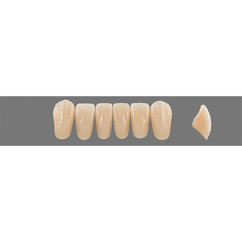 C2 Upper L41 Anterior